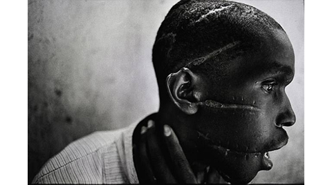 © James Nachtwey - Rwanda