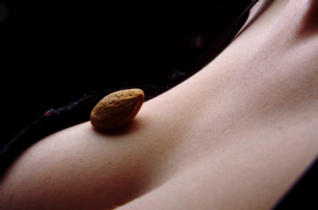 présentation d’une amence